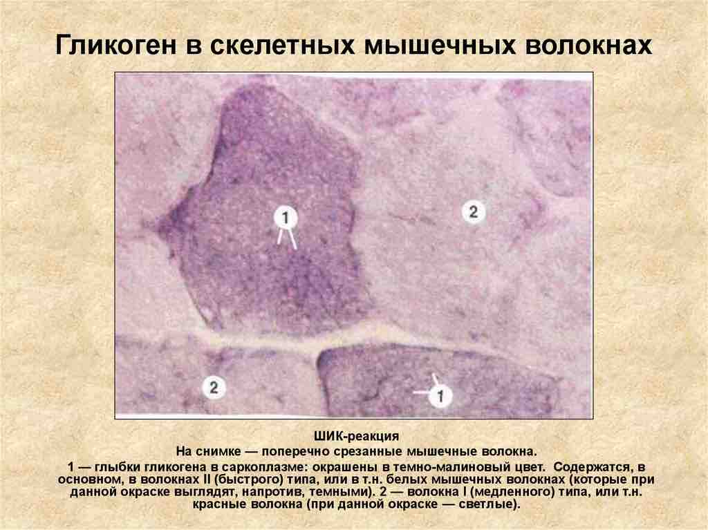 Гликоген в мышцах. Глыбки гликогена в мышечных волокнах. Накопление гликогена в мышцах. Количество гликогена в мышцах.